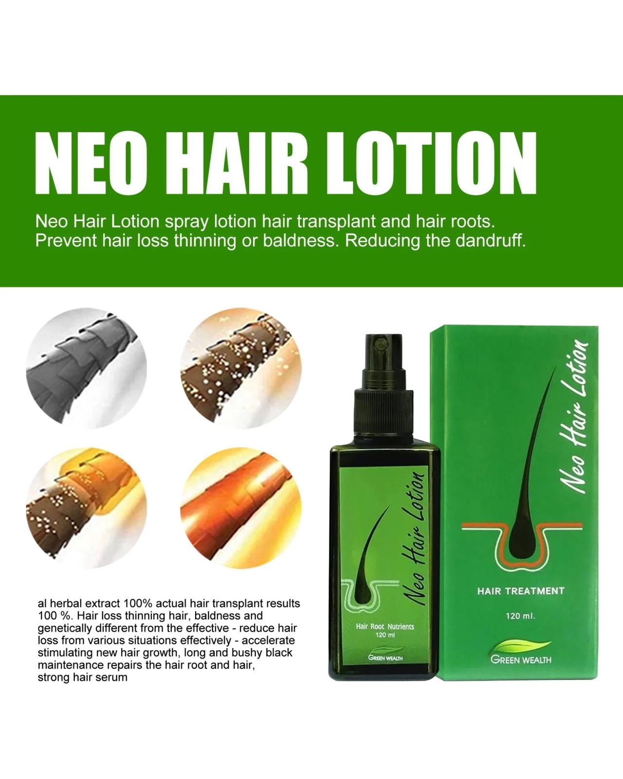 Neo Hair Lotion - Original