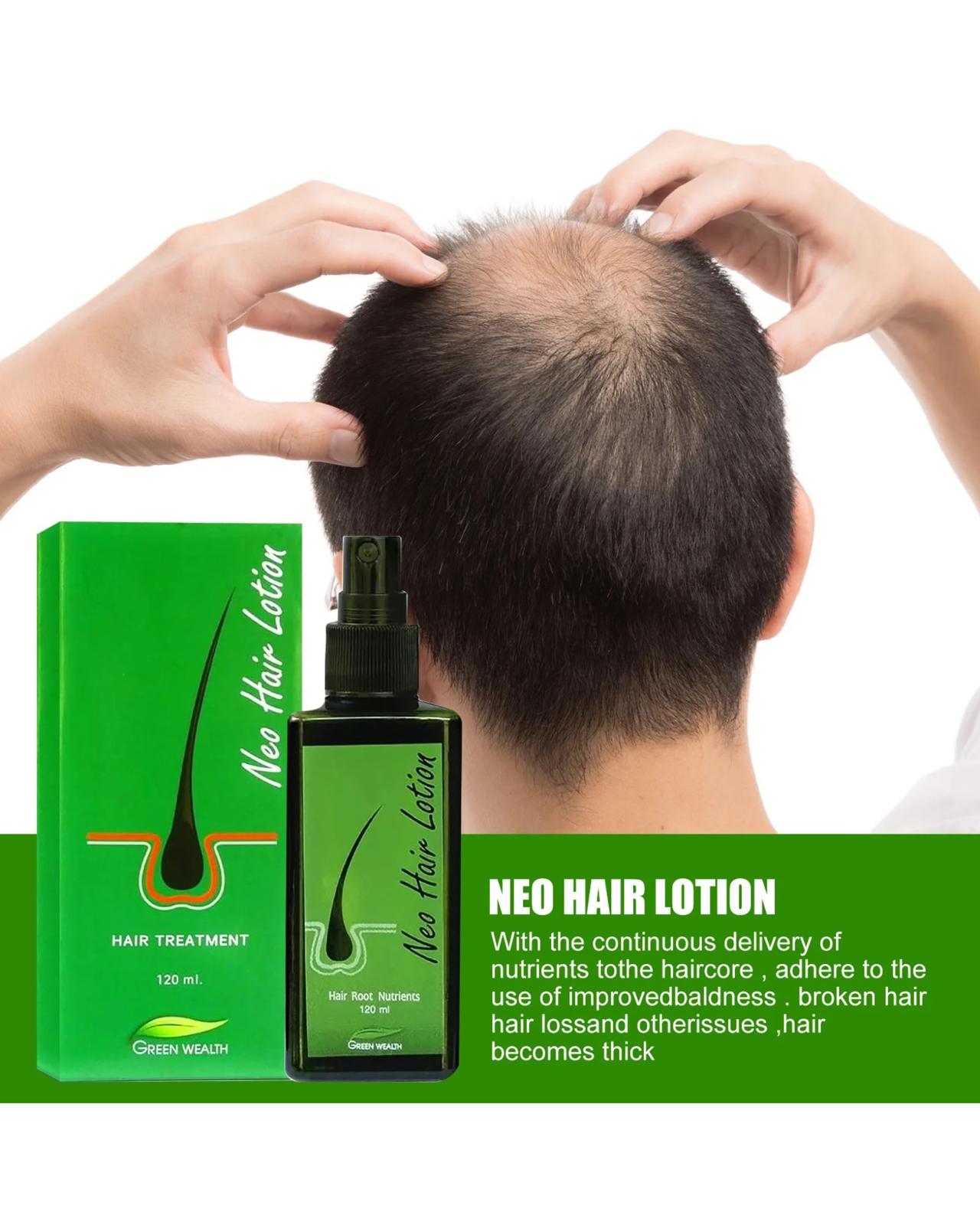 Neo Hair Lotion - Original
