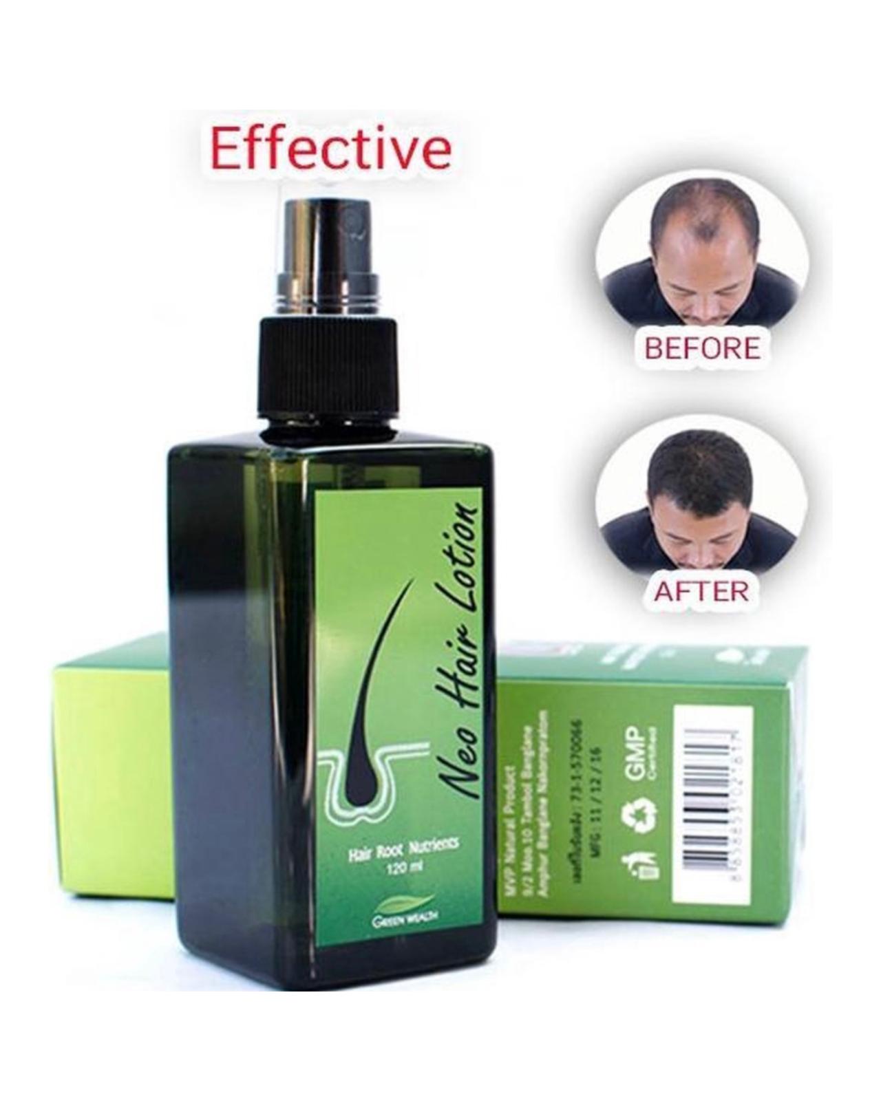 Neo Hair Lotion - Original